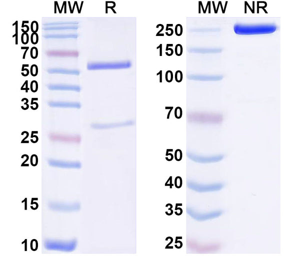 SDS-PAGE for Anti-Human LRRC15/LIB Antibody (SAA1761)