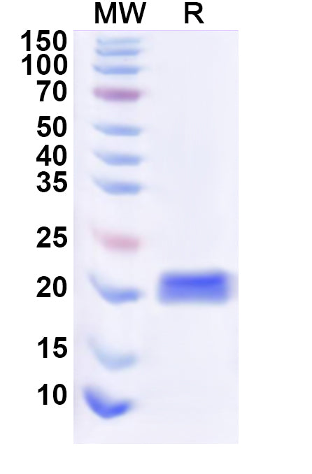 Recombinant Human CD368/CLEC4D Protein, N-His
