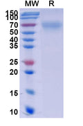 Recombinant Human CD264/TNFRSF10D Protein, C-Fc