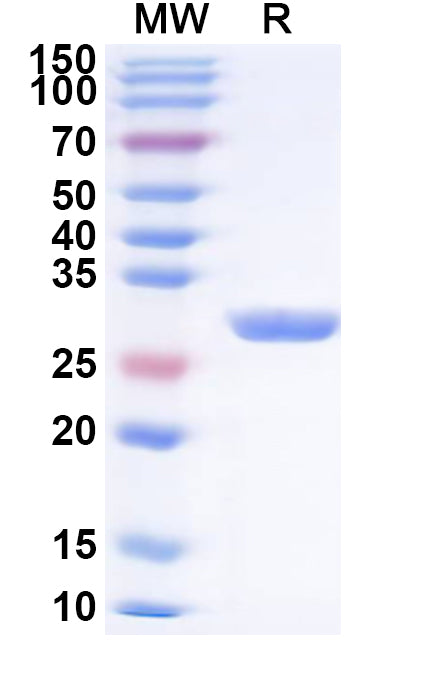 Recombinant Human PINK1 Protein, N-His
