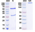 SDS-PAGE for Anti-PINK1 Antibody (N357/6).