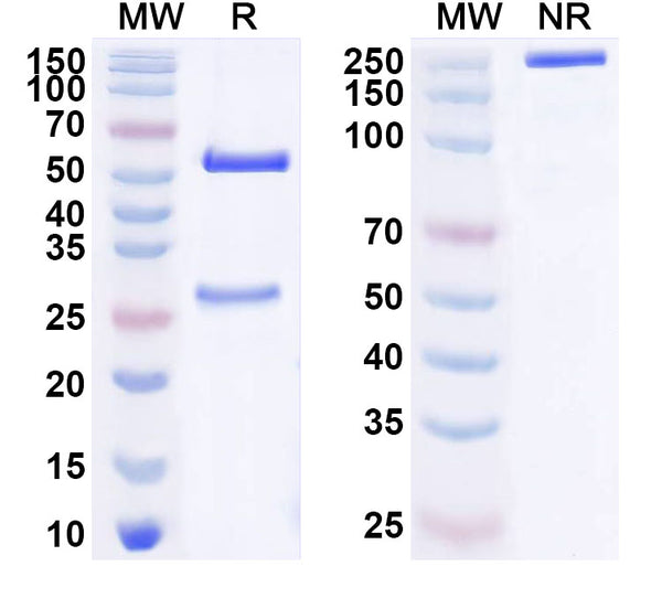 SDS-PAGE for Anti-PINK1 Antibody (N4/15).