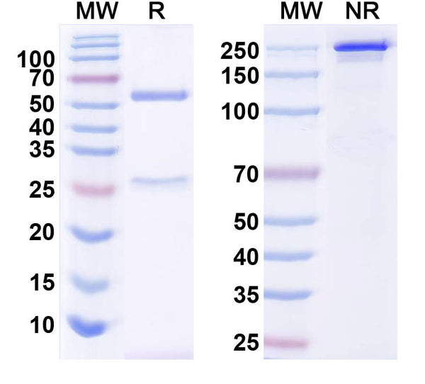 SDS-PAGE for Anti-PINK1 Antibody (N4/19)