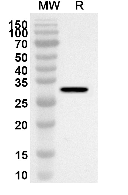 Western blot analysis was performed using anti-SGK2 polyclonal antibody at 1ug/mL on recombinant SGK2 (Catalog No. HV801012).