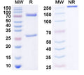 SDS-PAGE for Anti-Human FGF21 Antibody (SAA0440)