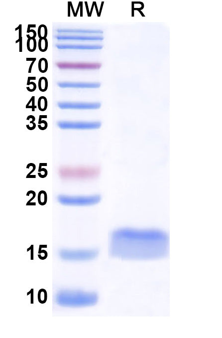 SDS-PAGE for Anti-Human CD273/PD-L2/PDCD1LG2 Nanobody (SAA1281)