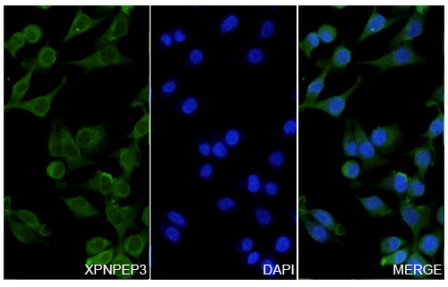 A549 cells were fixed with 4% paraformaldehyde for 20 minutes, followed by blocking with 5% goat serum for 1 hour. The cells were then incubated with a primary antibody targeting XPNPEP3 (HV814014) at a concentration of 41.5 ug/ml overnight at 4°C. Afterward, the cells were incubated with a secondary antibody, Goat Anti-Rabbit IgG (Alexa Fluor-488) for 50 minutes at room temperature. The localization of XPNPEP3 was visualized (shown in green), and nuclear DNA was stained with DAPI (shown in blue).