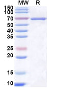Recombinant Human SLC27A4 Protein, N-His