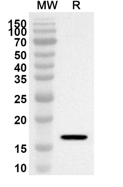 Western blot analysis was performed using anti-NANOG polyclonal antibody at 1ug/mL on recombinant NANOG (Catalog No. HV819012).