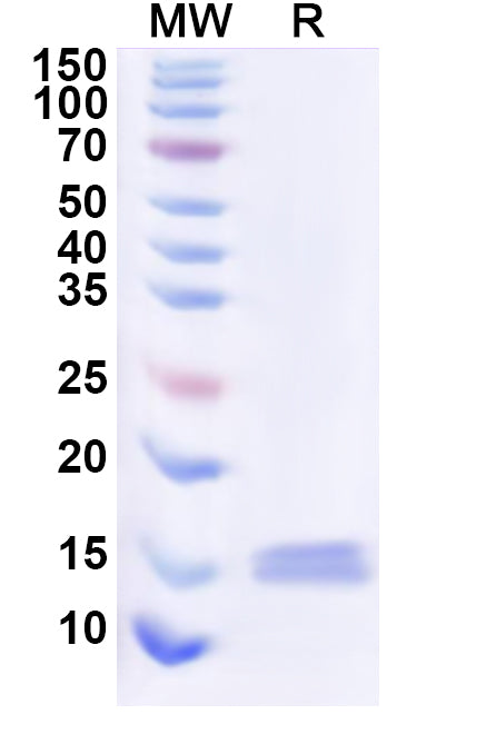 Recombinant Human CD369/CLEC7A Protein, N-His