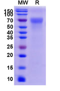 Recombinant Human CD113/NECTIN3 Protein, C-His