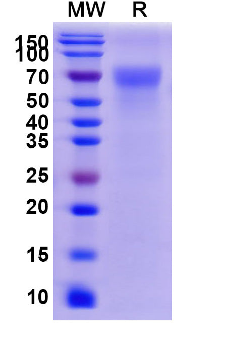 Recombinant Human CD113/NECTIN3 Protein, C-His