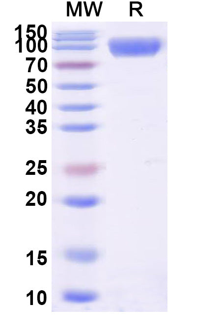 Recombinant Human CD113/NECTIN3 Protein, C-Fc