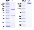 Anti-Human GPA33 Reference Antibody (KRN330) – Figure 1 of 1