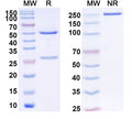 SDS-PAGE for Anti-Human GDF15 Monoclonal Antibody (1A346)