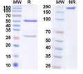 Anti-Human IL-20 Reference Antibody (Fletikumab) – Figure 1 of 1