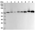 Western blot analysis was performed using anti-ATP6V1A polyclonal antibody at 1ug/mL  on various samples.
Lane 1: HepG2 cell lysate
Lane 2: K562 cell lysate
Lane 3: U87 cell lysate
Lane 4: Daudi cell lysate
Lane 5: NIH3T3 cell lysate
Lane 6: Mouse brain lysate
Lane 7: Mouse kidney lysate
Lane 8: Rat brain lysate