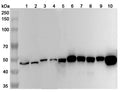 Western blot analysis was performed using anti-FEN1 polyclonal antibody at 1μg/ml on various samples.
Lane 1: Daudi cell lysate
Lane 2: NIH3T3 cell lysate
Lane 3: HepG2 cell lysate
Lane 4: 293T cell lysate
Lane 5: Jurkat cell lysate
Lane 6: PC-12 cell lysate
Lane 7: Mouse testis lysate
Lane 8: Mouse spleen lysate
Lane 9: Rat testis lysate
Lane 10: Rat spleen lysate