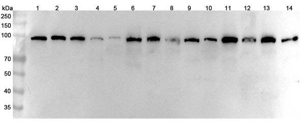 Western blot analysis was performed using anti-ACTN2 polyclonal antibody at 1μg/ml on various samples.
Lane 1: SH-SY5Y cell lysate
Lane 2: C2C12 cell lysate
Lane 3: Hela cell lysate
Lane 4: HT-29 cell lysate
Lane 5: Mouse brain lysate
Lane 6: Mouse lung lysate
Lane 7: Mouse heart lysate
Lane 8: Mouse muscle lysate
Lane 9: Mouse kidney lysate
Lane 10: Rat brain lysate
Lane11: Rat lung lysate
Lane12: Rat heart lysate
Lane13: Rat muscle lysate
Lane14: Rat kidney lysate