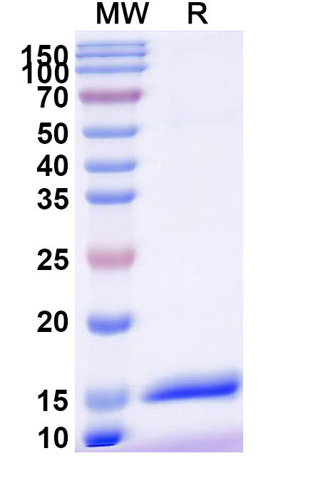 SDS-PAGE for Anti-Human CX3CR1 Nanobody (11H11)