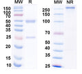 SDS-PAGE for Anti-GABA(A)R, Alpha2 Antibody (N399/19)