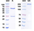 Anti-Human VEGFR2/KDR/Flk-1 Reference Antibody (Olinvacimab) – Figure 1 of 2