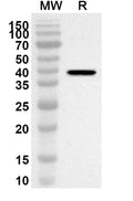 Western blot analysis was performed using anti-Human RPS6KA3 polyclonal antibody at 1ug/mL on recombinant Human RPS6KA3 (Catalog No. HW343012).