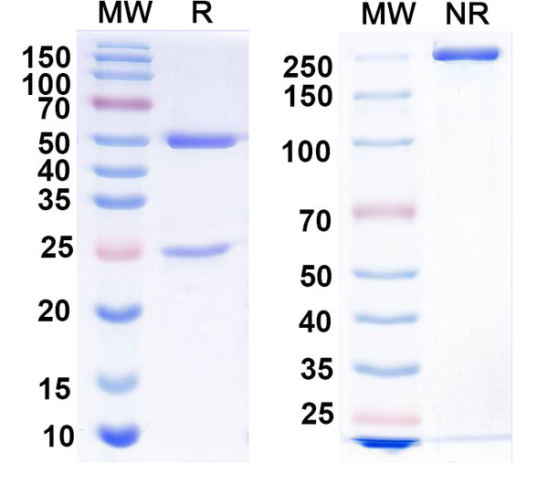 SDS-PAGE for Anti-MECP2 Antibody (N227/12)