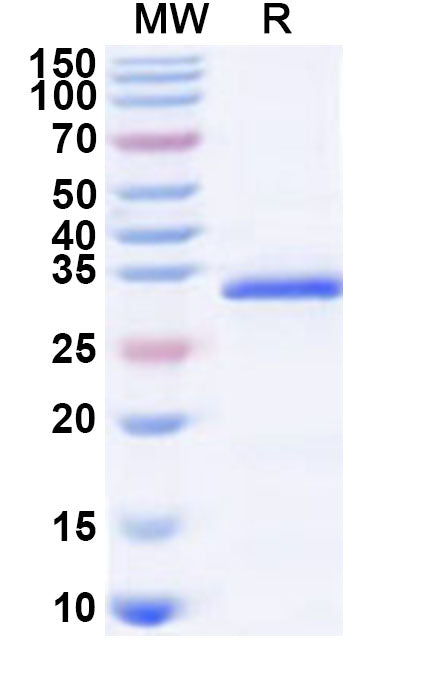 Recombinant Human ART1 Protein, N-His