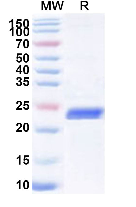 Recombinant Human CLCN3 Protein, N-His