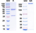 SDS-PAGE for Anti-Clcn3 Antibody (N258/7)