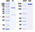 SDS-PAGE for Anti-Human TGFBR2/TGFR-2 Antibody (SAA1803)