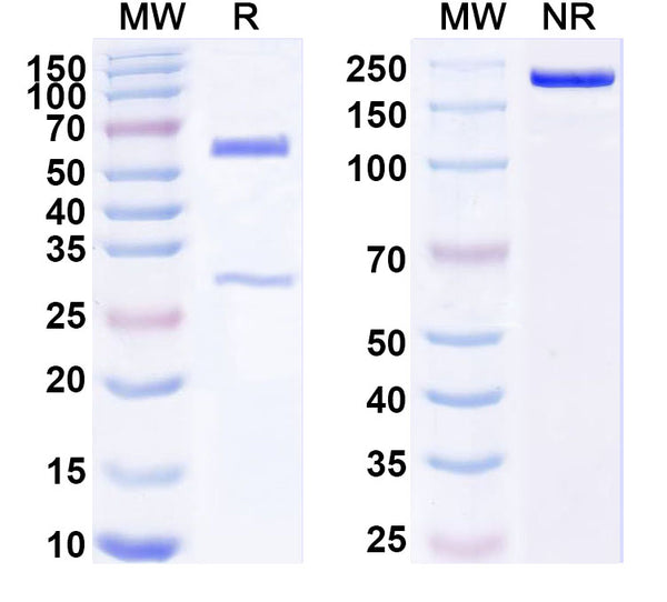 SDS-PAGE for Anti-Human TGFBR2/TGFR-2 Antibody (SAA1803)