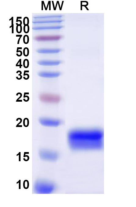 Recombinant Human TGFBR2/TGFR-2 Protein, N-His