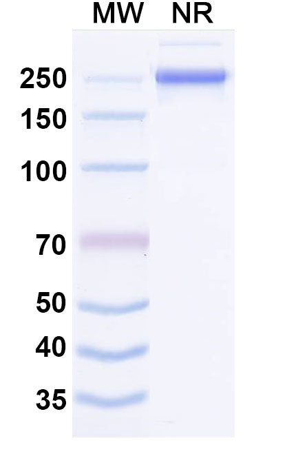 SDS-PAGE for Anti-Human MASP1 Antibody (SAA1639)