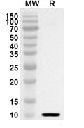 Western blot analysis was performed using anti-UBA7 polyclonal antibody at 1ug/mL on recombinant UBA7 (Catalog No. HW373012).