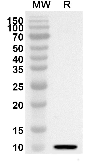 Western blot analysis was performed using anti-UBA7 polyclonal antibody at 1ug/mL on recombinant UBA7 (Catalog No. HW373012).