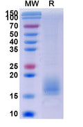 Recombinant Human ACVR1B Protein, C-His