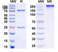 SDS-PAGE for Anti-Human NOS2/iNOS Antibody (SAA0105)