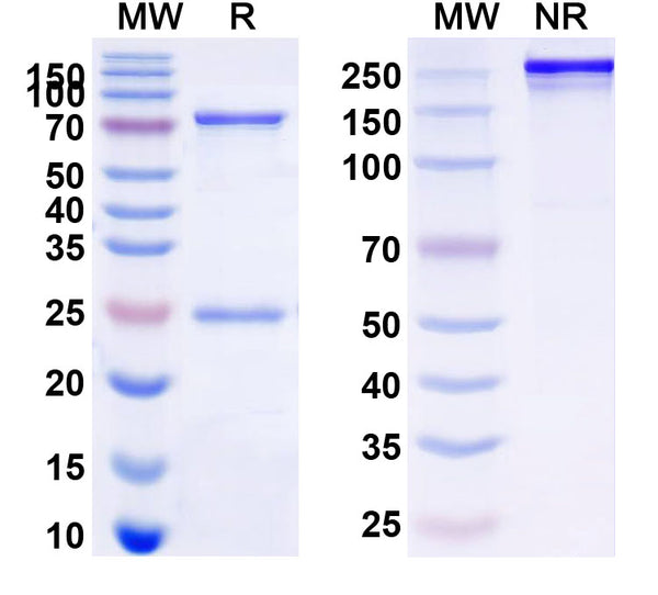 SDS-PAGE for Anti-Human NOS2/iNOS Antibody (SAA0105)