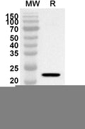Western blot analysis was performed using anti-CD130/IL6ST polyclonal antibody at 1ug/mL on recombinant CD130/IL6ST (Catalog No. HW398012).