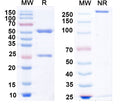 SDS-PAGE for Anti-GluK1/GluR5 kainate receptor Antibody (N298/14)