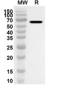 Western blot analysis was performed using anti-CD158b2/KIR2DL3 polyclonal antibody at 1ug/mL on recombinant CD158b2/KIR2DL3 (Catalog No. HW425012).