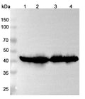 Western blot analysis was performed using anti-ACAA2 polyclonal antibody at 1μg/ml on various samples.
Lane 1: Mouse heart lysate
Lane 2: Mouse liver lysate
Lane 3: Rat heart lysate
Lane 4: Rat liver lysate