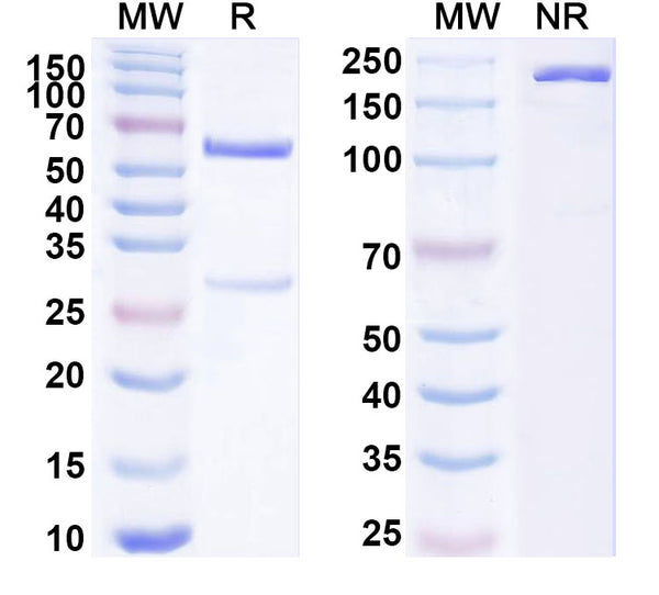SDS-PAGE for Anti-Human Histone H2B Antibody (SAA1806)