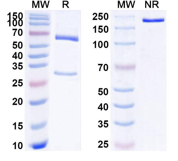 SDS-PAGE for Anti-Human CD153/TNFSF8/CD30L Antibody (SAA1789)