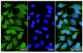 Hela cells were fixed with 4% paraformaldehyde for 20 minutes, followed by blocking with 5% goat serum for 1 hour. The cells were then incubated with a primary antibody targeting DHPS (HW482014) at a concentration of 24 ug/ml overnight at 4°C. Afterward, the cells were incubated with a secondary antibody, Goat Anti-Rabbit IgG (Alexa Fluor-488) for 50 minutes at room temperature. The localization of DHPS was visualized (shown in green), and nuclear DNA was stained with DAPI (shown in blue).