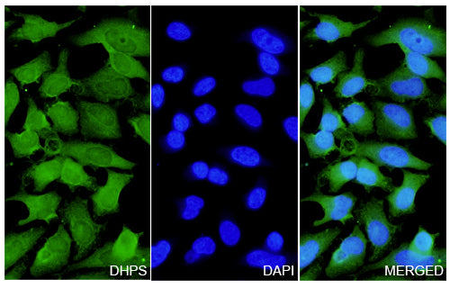 Hela cells were fixed with 4% paraformaldehyde for 20 minutes, followed by blocking with 5% goat serum for 1 hour. The cells were then incubated with a primary antibody targeting DHPS (HW482014) at a concentration of 24 ug/ml overnight at 4°C. Afterward, the cells were incubated with a secondary antibody, Goat Anti-Rabbit IgG (Alexa Fluor-488) for 50 minutes at room temperature. The localization of DHPS was visualized (shown in green), and nuclear DNA was stained with DAPI (shown in blue).