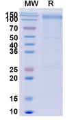 Recombinant Human CD118/LIFR Protein, C-His