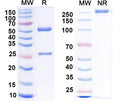 SDS-PAGE for Anti-Clcn1 Antibody (N305/1)